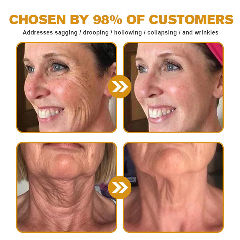 🧑⚕️Pureluxo® Botox Bee Venom Wrinkle Removal Cream- LAST DAY 90% OFF🧑⚕️ - Image 3