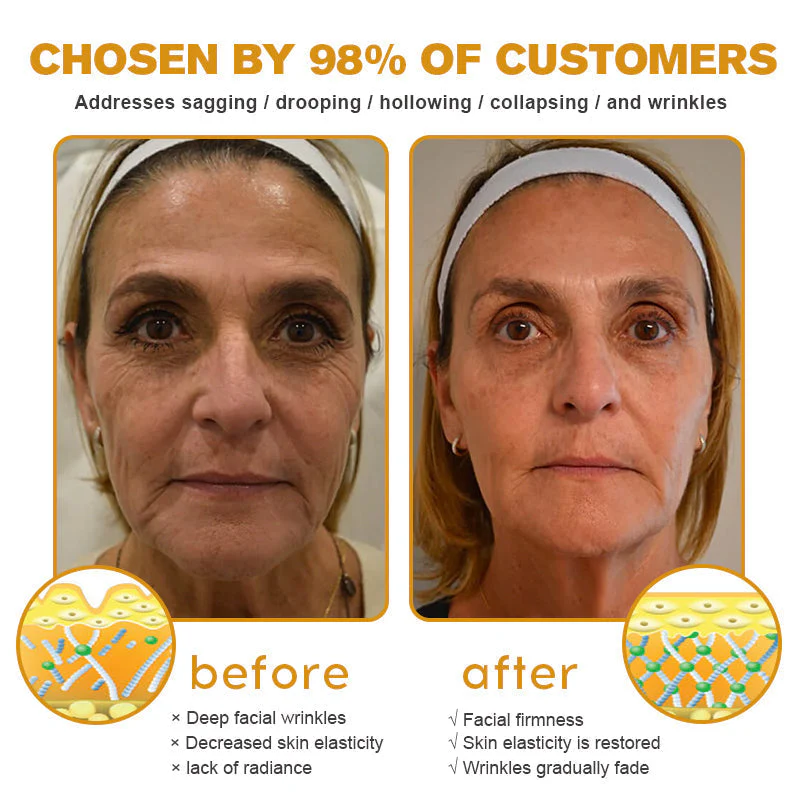 🧑⚕️Pureluxo® Botox Bee Venom Wrinkle Removal Cream- LAST DAY 90% OFF🧑⚕️ - Image 4