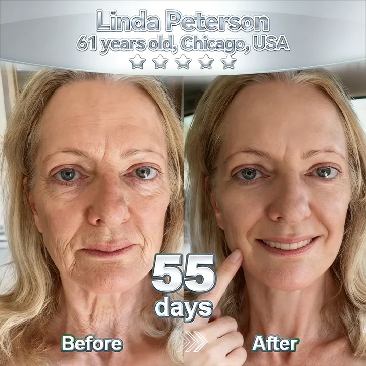 𝑷𝒖𝒓𝒆𝒍𝒖𝒙𝒐® 🇺🇸 Stem Cell–Inspired & GHK-Cu Powered Wrinkle-Refining Serum（Advanced Anti-Aging for Timeless, Radiant Skin） - Image 2